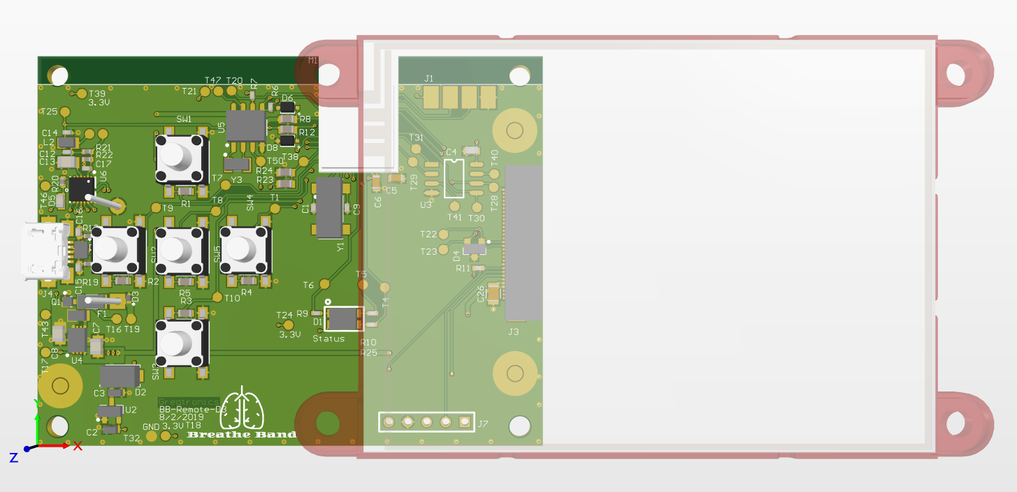 Cystic Fibrosis Therapeutic Device - Remote Top